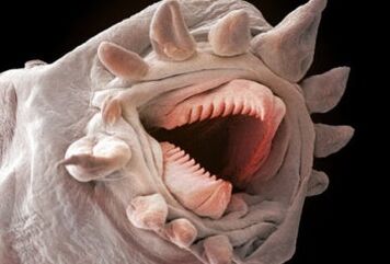 ce viermi pot trăi în corpul uman